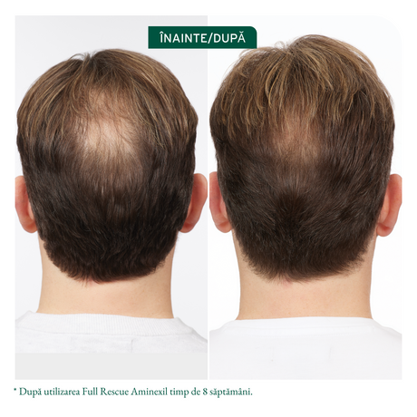 Biolage Full Rescue Tratament Leave-In cu Aminexil, Ulei de Rozmarin și Niacinamide – 6x10ml